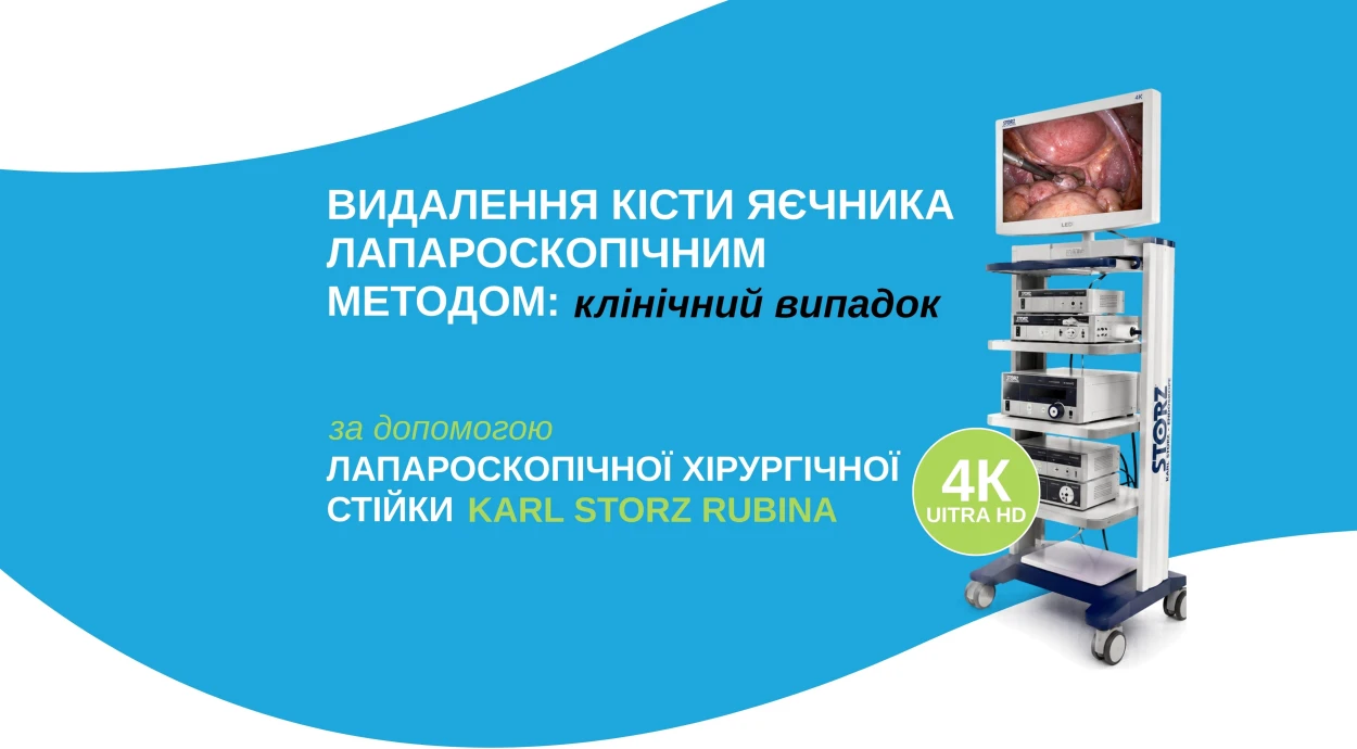 Удаление кисты яичника лапароскопическим методом: клинический случай