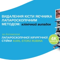 Удаление кисты яичника лапароскопическим методом: клинический случай