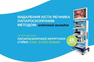 Удаление кисты яичника лапароскопическим методом: клинический случай